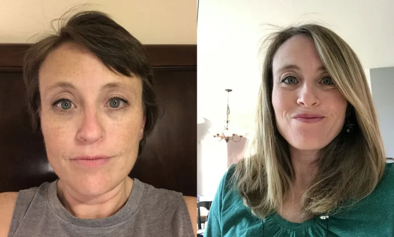 what helps hair growth after chemo