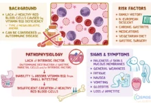 pernicious anemia symptoms